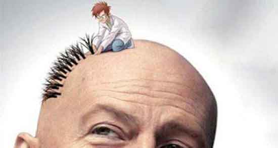 پیام تبریک برای کاشت مو ؛ بهترین جملات برای کاشت مو