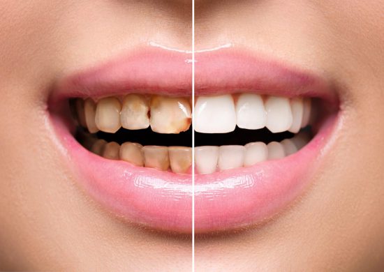 C:\Users\se7en\Desktop\AdobeStock_114090596-e1598174048469.jpeg