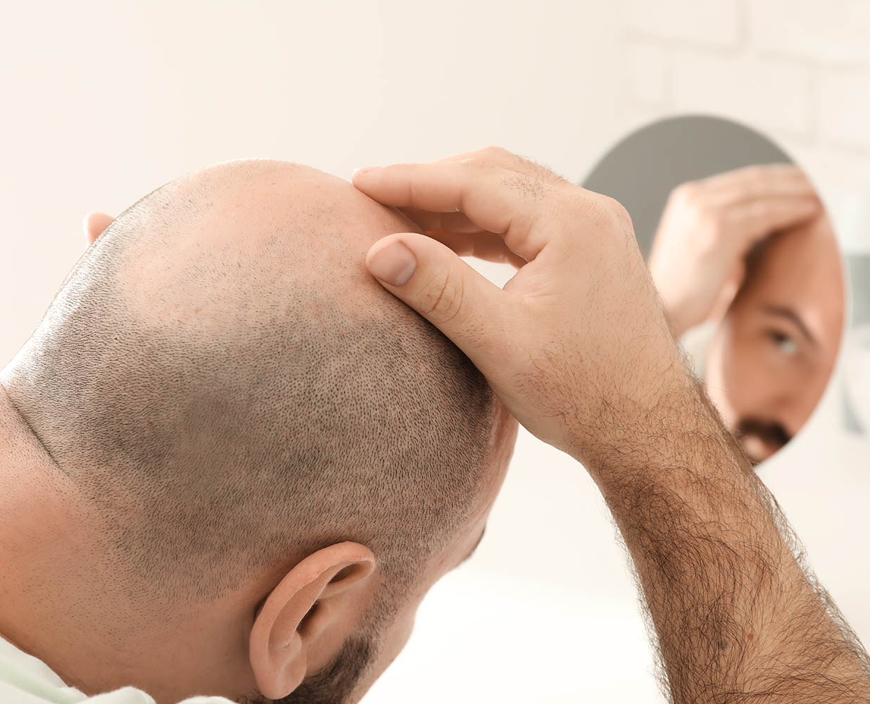 C:\Users\windowa7\Desktop\Hair-Transplant-Toronto-3.jpg