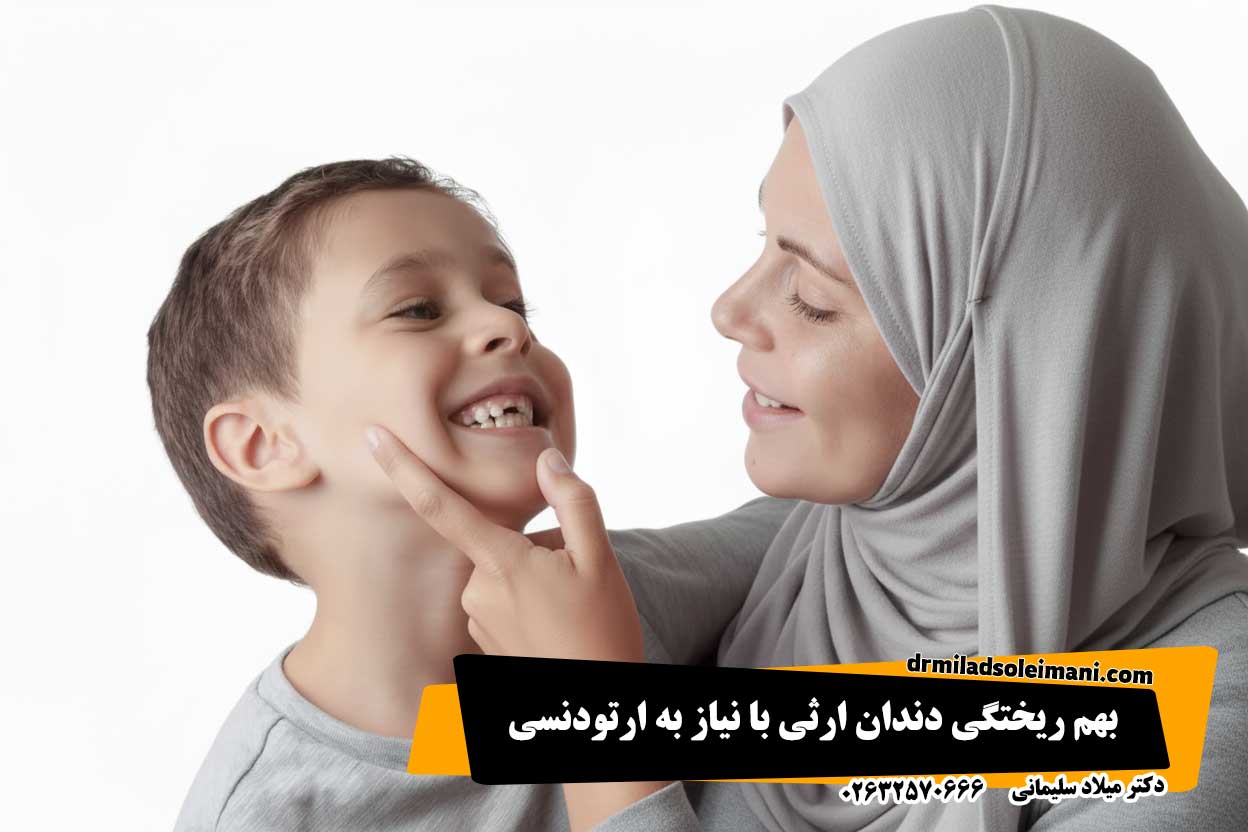 بهم ریختگی دندان ارثی با نیاز به ارتودنسی در کرج