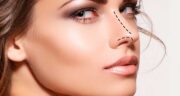 تغییر صدا پس از جاحی بینی! آیا حقیقت دارد؟